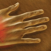 Skin Cancer Foundation