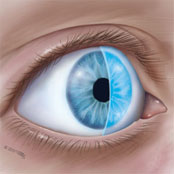 Tear Layer